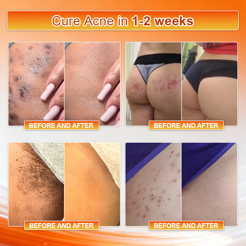 👙👙𝐎𝐟𝐟𝐢𝐜𝐢𝐚𝐥 𝐁𝐫𝐚𝐧𝐝 𝐒𝐭𝐨𝐫𝐞 | Von𝑢𝑡𝑟𝑖® 𝟐𝟎𝟐𝟔 𝐌𝐨𝐫𝐢𝐧𝐠𝐚 & 𝐁𝐞𝐫𝐛𝐞𝐫𝐢𝐧𝐞 𝟒-𝐈𝐧-𝟏 𝐌𝐢𝐜𝐫𝐨-𝐏𝐚𝐫𝐭𝐢𝐜𝐥𝐞 𝐒𝐜𝐮𝐥𝐩𝐭𝐢𝐧𝐠 & 𝐅𝐚𝐭-𝐁𝐮𝐫𝐧 𝐒𝐡𝐨𝐫𝐭𝐬