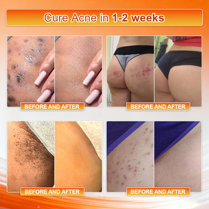 👙👙𝐎𝐟𝐟𝐢𝐜𝐢𝐚𝐥 𝐁𝐫𝐚𝐧𝐝 𝐒𝐭𝐨𝐫𝐞 | Von𝑢𝑡𝑟𝑖® 𝟐𝟎𝟐𝟔 𝐌𝐨𝐫𝐢𝐧𝐠𝐚 & 𝐁𝐞𝐫𝐛𝐞𝐫𝐢𝐧𝐞 𝟒-𝐈𝐧-𝟏 𝐌𝐢𝐜𝐫𝐨-𝐏𝐚𝐫𝐭𝐢𝐜𝐥𝐞 𝐒𝐜𝐮𝐥𝐩𝐭𝐢𝐧𝐠 & 𝐅𝐚𝐭-𝐁𝐮𝐫𝐧 𝐒𝐡𝐨𝐫𝐭𝐬